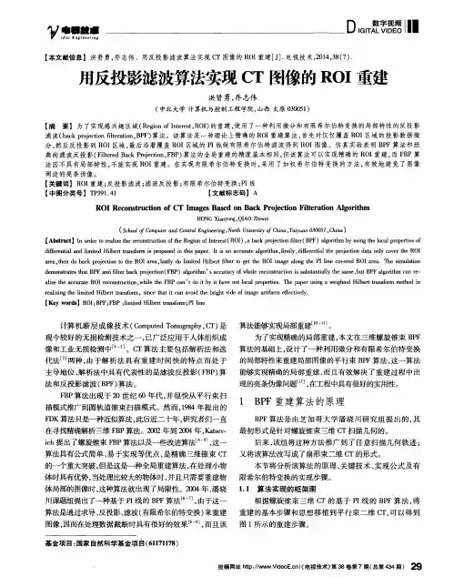 用反投影滤波算法实现CT图像的ROI重建