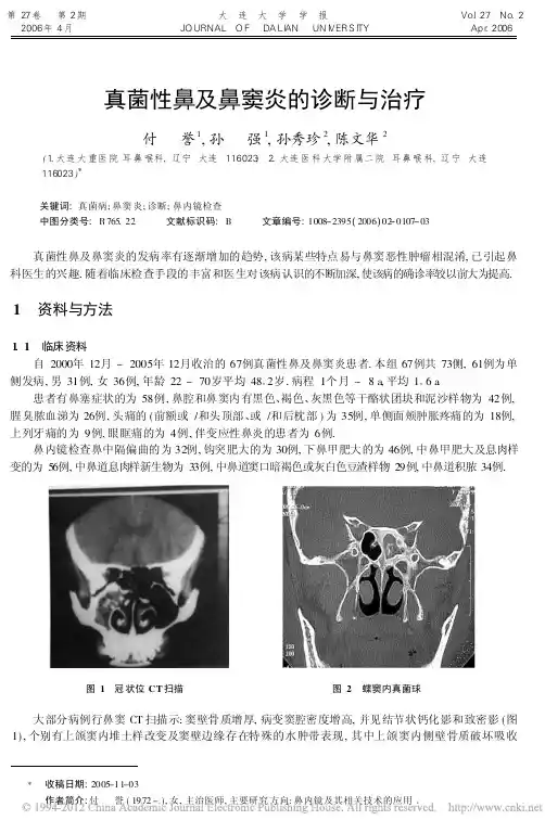 真菌性鼻及鼻窦炎的诊断与治疗