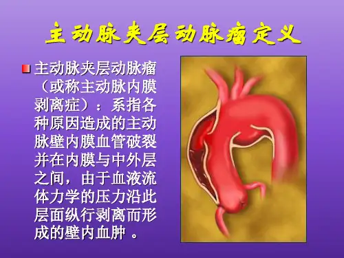 医学主动脉夹层动脉瘤诊断及治疗策略