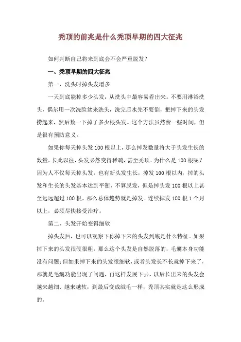 秃顶的前兆是什么 秃顶早期的四大征兆