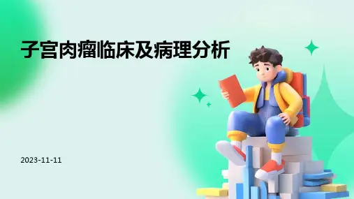 子宫肉瘤临床及病理分析