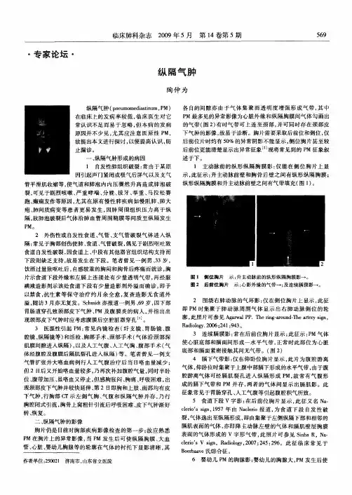 纵隔气肿