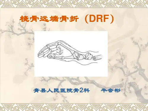 桡骨远端骨折