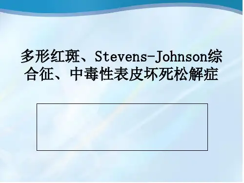 我讲多形红斑