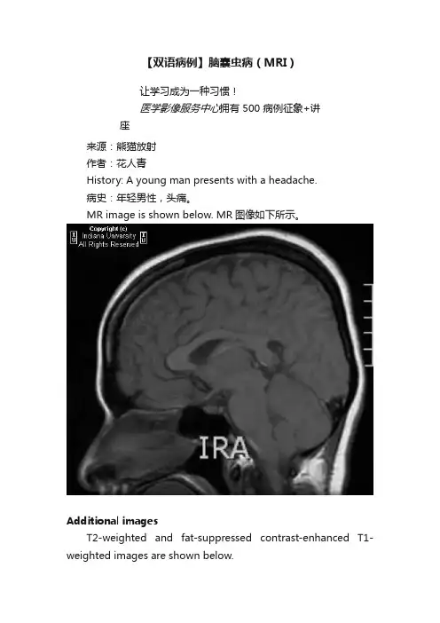 【双语病例】脑囊虫病（MRI）