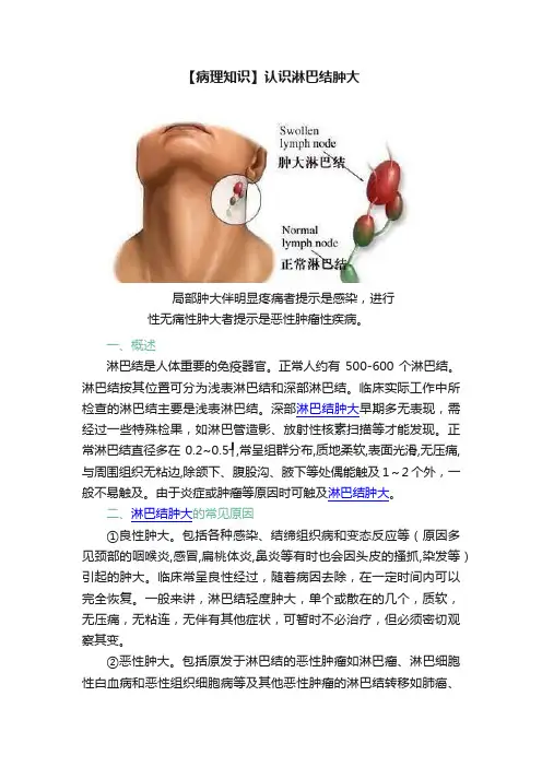 【病理知识】认识淋巴结肿大