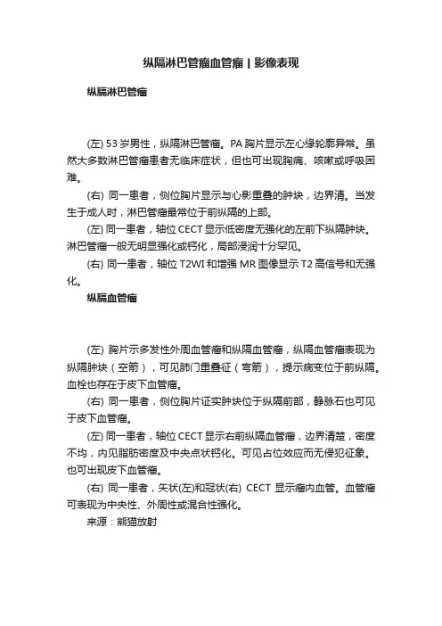 ?纵隔淋巴管瘤血管瘤丨影像表现