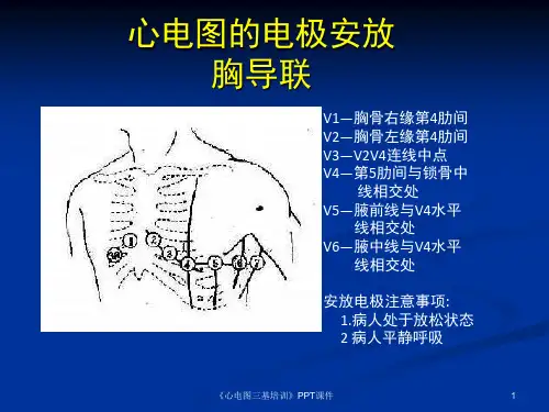 心电图三基培训课件