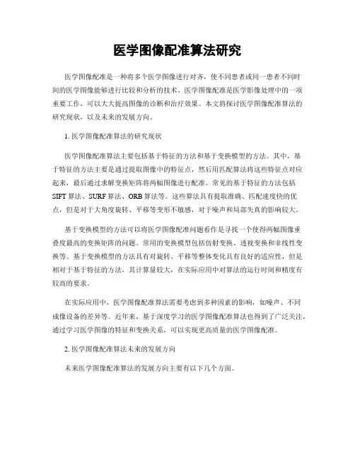 医学图像配准算法研究
