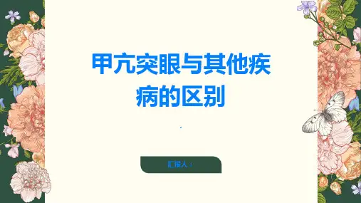 甲亢突眼甲亢突眼与其他疾病有何不同