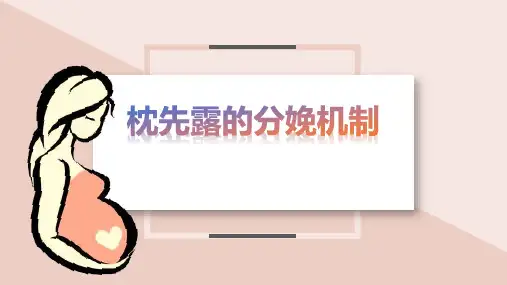 孕育分娩 正常分娩 枕先露的分娩机制
