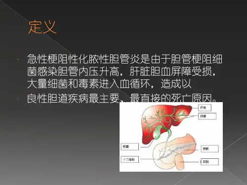 急性梗阻性化脓性胆管炎2