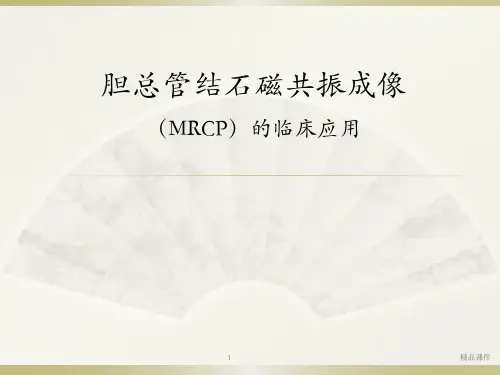 胆总管结石医学PPT