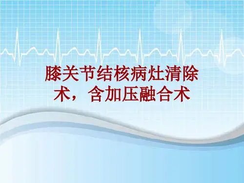手术讲解模板：膝关节结核病灶清除术,含加压融合术