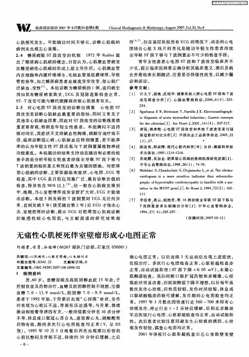 无痛性心肌梗死伴室壁瘤形成心电图正常