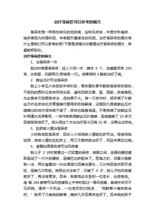 治疗荨麻疹可以参考的偏方