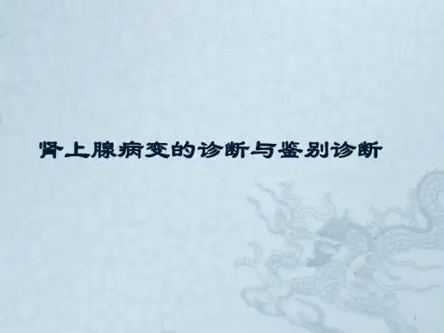 肾上腺病变的诊断与鉴别诊断ppt课件