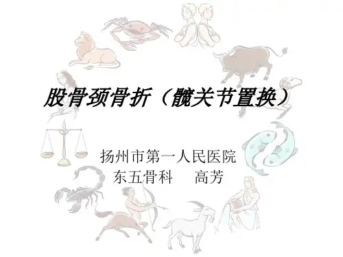 股骨颈骨折