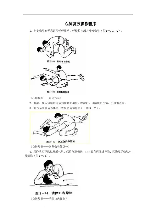 心肺复苏流程图