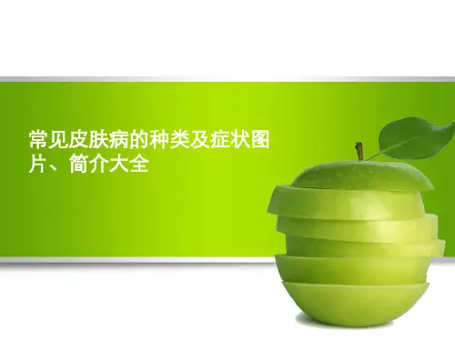 常见皮肤病的种类及症状图片、简介大全