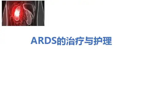 ARDS [修复的]