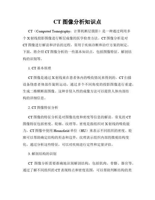 CT图像分析知识点