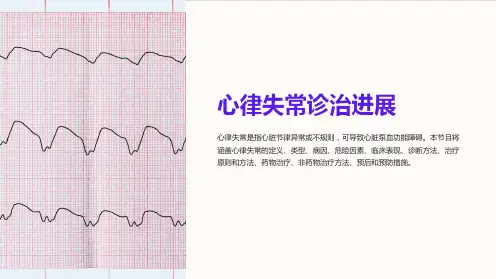 心律失常诊治进展