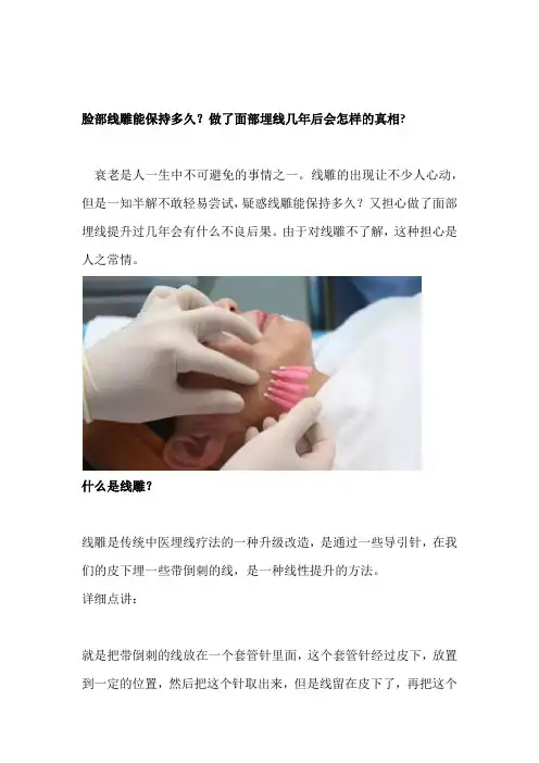 脸部线雕能保持多久