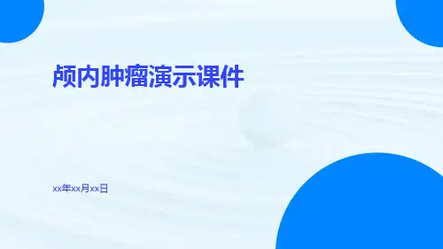 (医学课件)颅内肿瘤演示课件