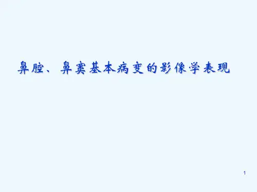 鼻腔、鼻窦基本病变的影像学表现