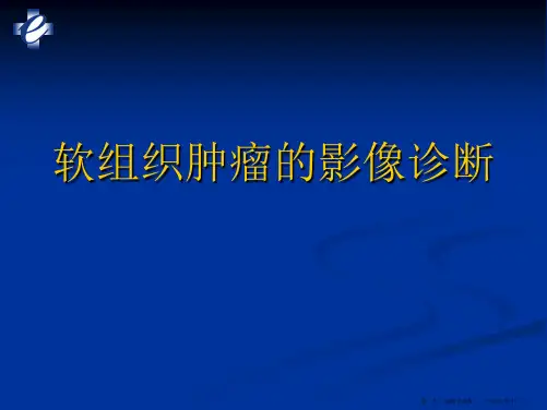 软组织肿瘤