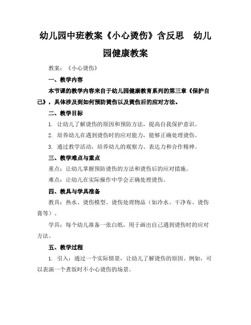 幼儿园中班教案《小心烫伤》含反思 - 幼儿园健康教案