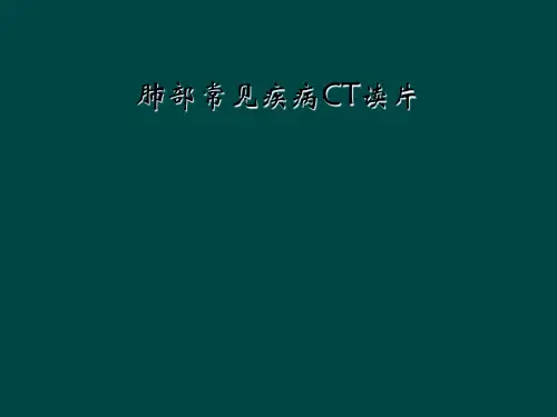 肺部常见疾病CT读片