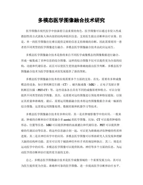 多模态医学图像融合技术研究