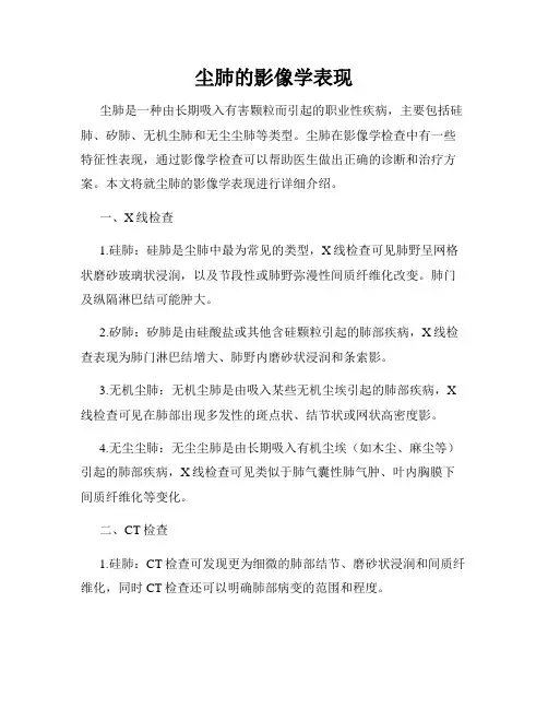 尘肺的影像学表现
