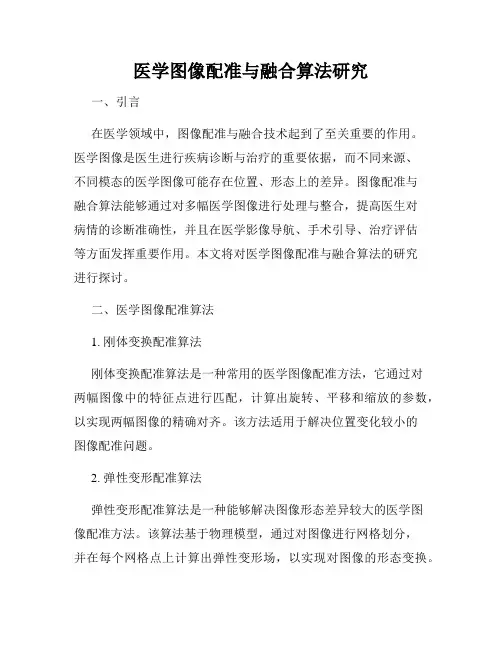 医学图像配准与融合算法研究