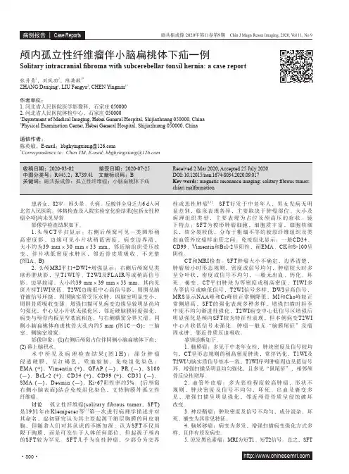 颅内孤立性纤维瘤伴小脑扁桃体下疝一例