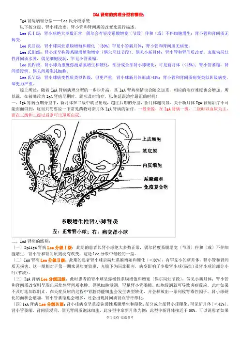 IGA肾病的病理分型及治疗