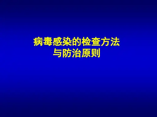 病毒感染的检查方法与防治原则