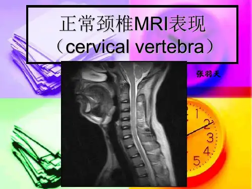 颈椎MRI解剖与常用数据ppt课件