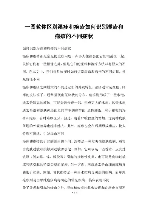 一图教你区别湿疹和疱疹如何识别湿疹和疱疹的不同症状