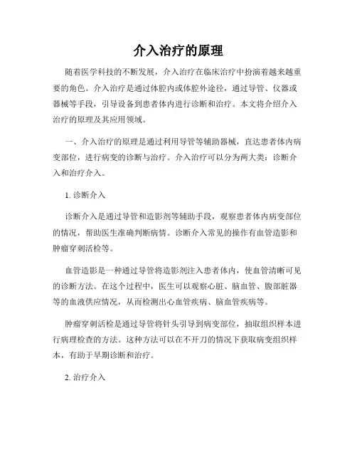 介入治疗的原理