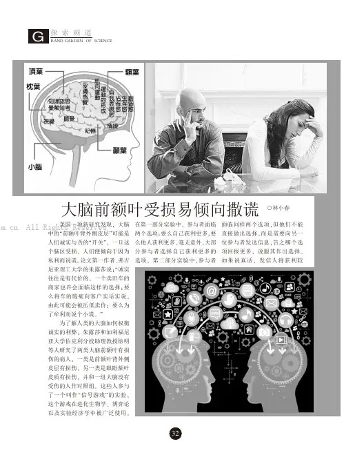 大脑前额叶受损易倾向撒谎