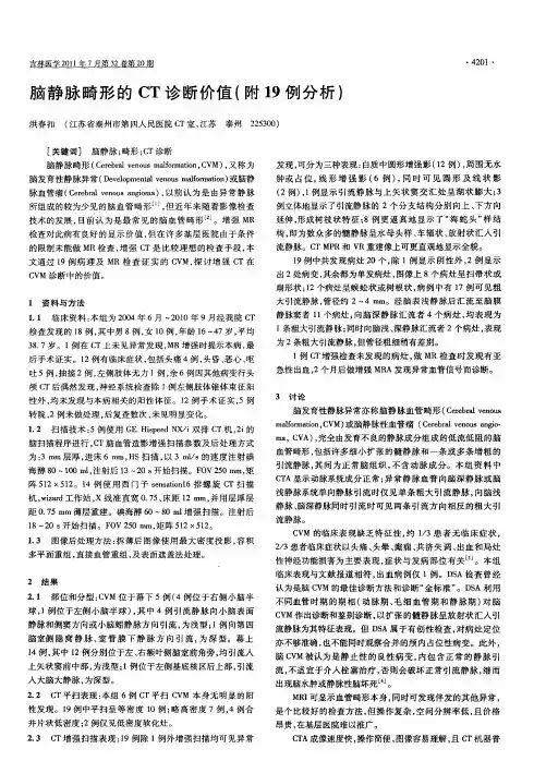 脑静脉畸形的CT诊断价值(附19例分析)