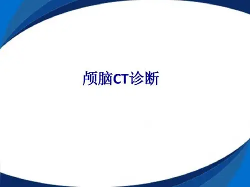 颅脑CT