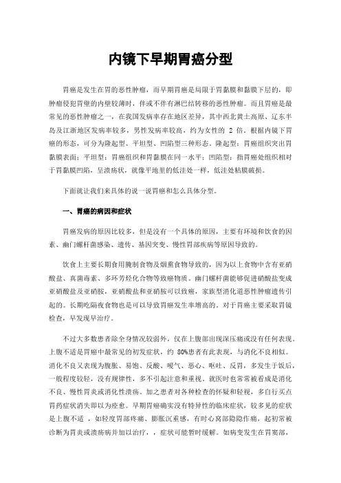 内镜下早期胃癌分型