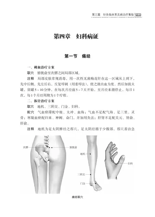 董氏奇穴与十四经穴临证治验第三篇针灸临床常见病治疗集验篱四章妇科病证