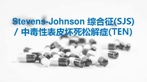 Stevens-Johnson 综合征及中毒性表皮坏死松解症