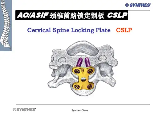 颈椎前路锁定钢板  CSLP-NA-SS