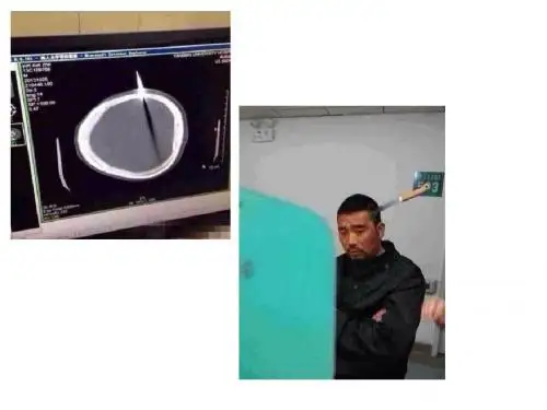 高考英语倒装句